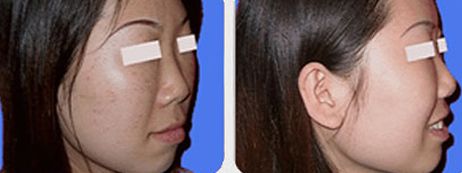 上海九院某醫(yī)生空前火爆！有幸親歷他的高超吸脂術(shù)！價(jià)格一覽來(lái)啦！