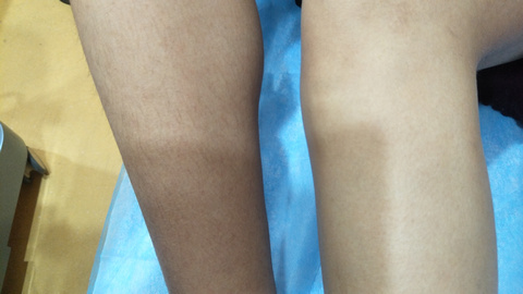 湘西自治州人民醫(yī)院燒傷美容整形科是否能滿足療效和口碑的雙重期望？有哪些備受推崇的醫(yī)生值得推薦？