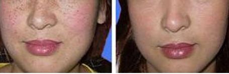 龍崗中心醫(yī)院整形科的雙眼皮修復(fù)醫(yī)生怎么樣？