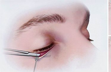 鼻部整形專家推薦：北京伊萊美哪位醫(yī)生技術(shù)一流？王冀耕、李旭東等好評(píng)如潮！