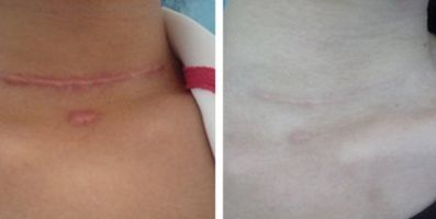 461醫(yī)院的口腔科-獨特的牙科解決方案涵蓋種植牙案例