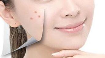 溫州醫(yī)科大學附屬第二醫(yī)院整形科除皺，技術型醫(yī)生和知識介紹怎么樣呢？