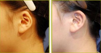 沈陽(yáng)整形行業(yè)的隆鼻醫(yī)生排名Top10  網(wǎng)友推薦集結(jié)