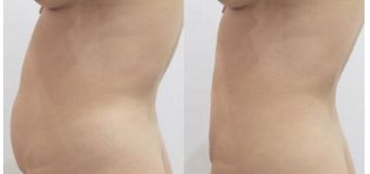 全國鼻子整形醫(yī)院排名揭曉，這幾家醫(yī)院上榜！