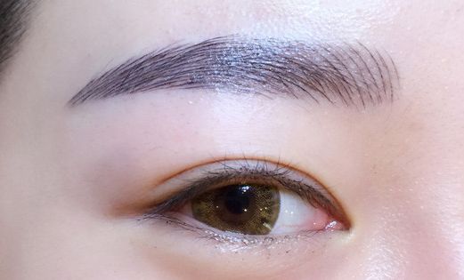 徐利剛：杭州藝星整形臨床實力派！鼻子整形解析，案例詳解！