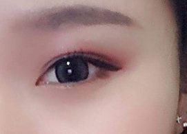 蔣小花醫(yī)生手術(shù)的實際操作方法和評價分享，多樣風(fēng)格消解揭秘！