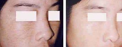 福州美貝爾醫(yī)療美容門診部：薛欣醫(yī)生用戶評(píng)價(jià)高？真實(shí)案例分享！