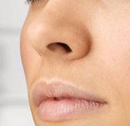 大連最受歡迎的植發(fā)醫(yī)院技術(shù)怎么樣？全面評(píng)測(cè)揭曉