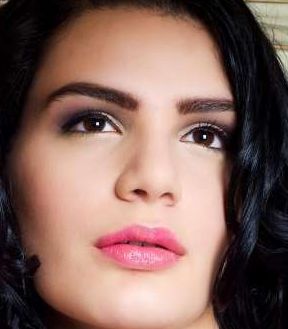 王太玲雙眼皮修復(fù)前后效果展示，讓您信心重拾！