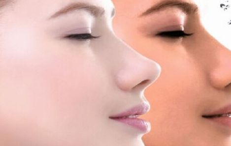 國(guó)內(nèi)十大隆鼻醫(yī)院官方認(rèn)證！精選口碑醫(yī)院，曙光、美萊等實(shí)力推薦！