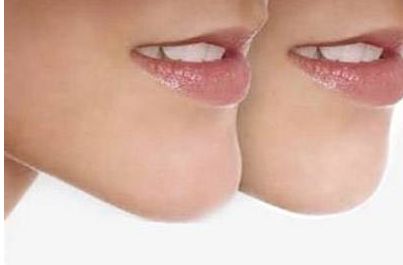 成都頂尖的玻尿酸注射醫(yī)生排行榜，六位信譽(yù)好的醫(yī)生介紹