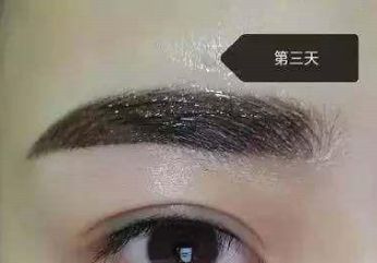 長沙美萊隆胸醫(yī)生的評價如何？醫(yī)療背景與口碑信息一一梳理