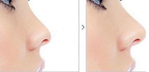 醫(yī)術(shù)精湛！感受武漢整形醫(yī)院魅力，解鎖變美新境界！