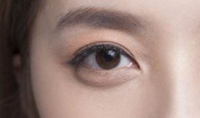 2023最新！精彩譚謙雙眼皮案例大揭秘，實(shí)景術(shù)后反饋引爆網(wǎng)絡(luò)