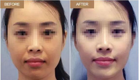 蘭州整形醫(yī)院優(yōu)秀專家團(tuán)隊(duì)，維多利亞再次榮膺榜首稱號(hào)！