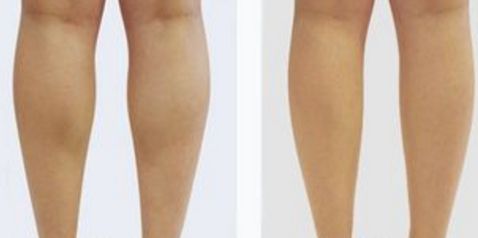 北京八大處楊欣好評傳遍朋友圈！揭秘90天顛覆性隆鼻之旅