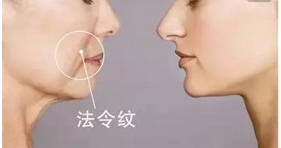 韋元強(qiáng)swan吸脂修復(fù)方法介紹，相關(guān)醫(yī)院推薦