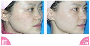 榆林二院整形科值得信賴嗎？醫(yī)生專業(yè)，雙眼皮案例豐富，收費(fèi)明明白白，專家指南！