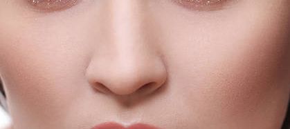 李湘源隆鼻案例，技術與反饋圖及價格表分享！