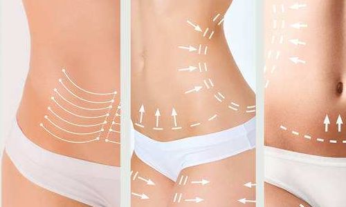 2023年武漢吸脂抽脂醫(yī)生（專家）技術(shù)分享：張軍、張繼強(qiáng)、劉洋等探討