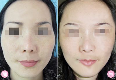 南京頂級整形醫(yī)院曝光！綜合美貝爾、華韓奇致、蘇王等高評分，絕對讓您驚艷！