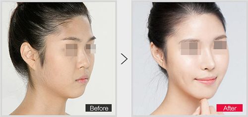 哈爾濱脫毛整形哪家醫(yī)院名聲比較好？這些榜單上的實(shí)力醫(yī)院受人推崇