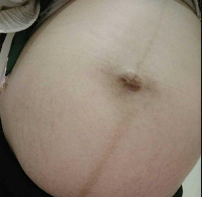 揭示濰坊市熱門隆鼻醫(yī)院排行榜！尋找濰坊隆鼻首選醫(yī)療機構(gòu)TOP10！