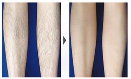 2023年醫(yī)療美容門戶,了解成都整形醫(yī)院實力，權(quán)威機構(gòu)匯總