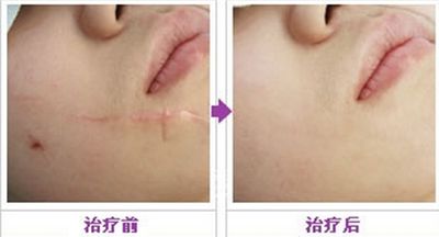 重慶神奇醫(yī)療機構(gòu)，致力于脂肪填充醫(yī)療服務的機構(gòu)盤點