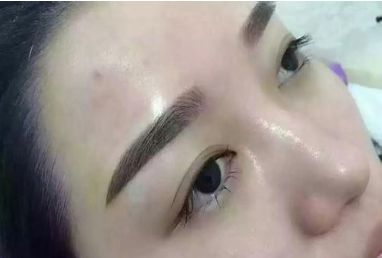 成都哪些整形醫(yī)院在皮膚美容領(lǐng)域具備優(yōu)勢(shì)？