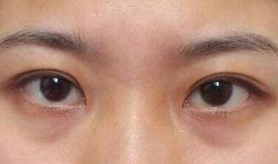 杭州東方整形吸脂到底值不值得嘗試？