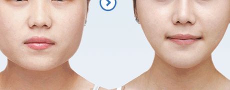 461醫(yī)院植牙科綜合評(píng)測(cè)：醫(yī)生隊(duì)伍強(qiáng)大，成功案例豐富，價(jià)格表詳解