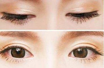 青島壹美天成整形醫(yī)院的隆鼻技術(shù)如何？看看這些真實案例！