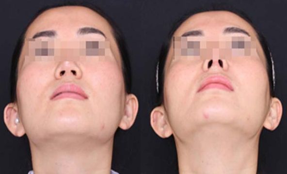 樂(lè)山整形美容醫(yī)院綜合排行榜