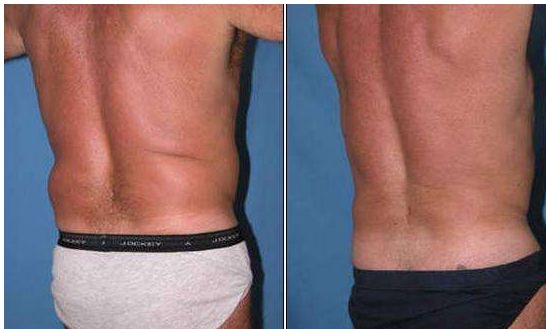 成都隆鼻專(zhuān)家推薦的技術(shù)排名前十，絕對(duì)讓你滿意