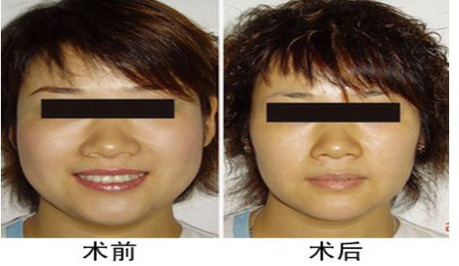 北京祛斑醫(yī)院三甲排行榜：北京哪家祛斑醫(yī)院好？