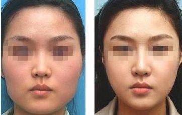 南通瘦身整形醫(yī)院哪家專業(yè)？