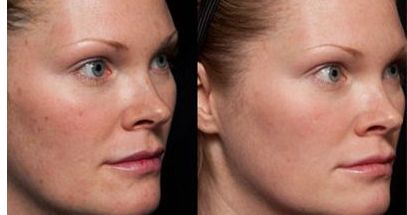 臺(tái)州市哪家做除皺瘦臉整形好的美容醫(yī)院推薦