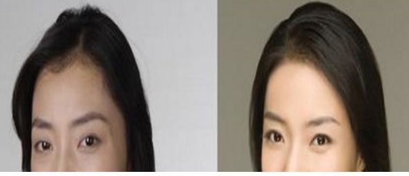 成都悅己醫(yī)美醫(yī)生實力強，顧客口碑好價格合適