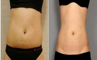 成都哪家醫(yī)院適合做光子嫩膚？排名前五的醫(yī)美機構推薦！