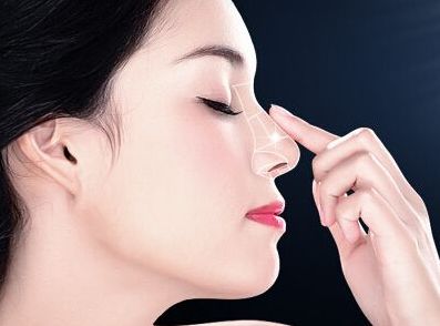 深圳隆鼻哪家好？易培金醫(yī)生經(jīng)驗(yàn)口碑解析測評(píng)