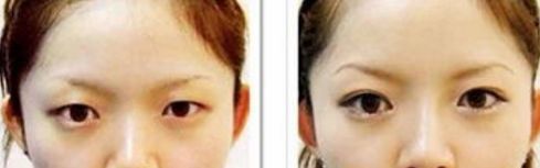 天津有沒(méi)有靠譜的去皺美容醫(yī)院？