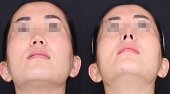 蘭州經(jīng)驗豐富的脂肪豐胸醫(yī)生推薦：逯巖、郭曉磊、雷蓓