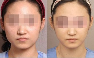 湛江有哪些頂尖整形美容醫(yī)院值得關(guān)注？