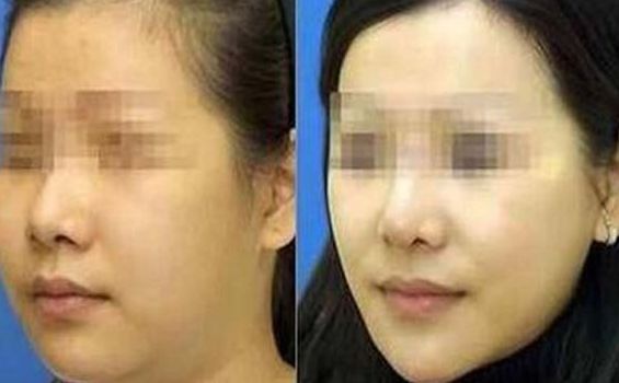 優(yōu)質(zhì)貴陽隆胸醫(yī)院排行榜公布，這五家醫(yī)院值得關(guān)注