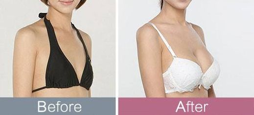 東莞哪家整形醫(yī)院頗受推薦？