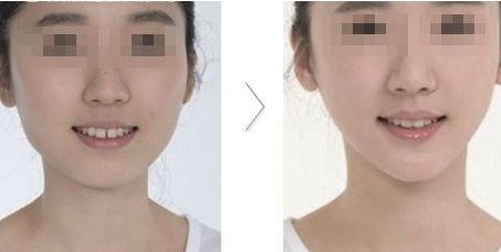 哪家醫(yī)院在北京具有卓越的醫(yī)美科技和服務(wù)？歐洲醫(yī)學(xué)中心、北京協(xié)和、北大人民醫(yī)院等公立單位有何特色？