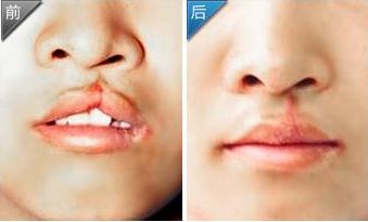 雅典娜美容診所價(jià)目公布及醫(yī)生簡介【更新】