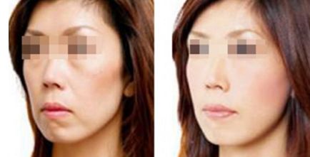 成都頂尖整形醫(yī)院評(píng)價(jià)如何？