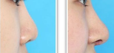 北京顴骨手術(shù)專家張笑天技術(shù)口碑好，值得信賴